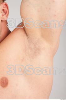 Underarm texture of Gene 0001